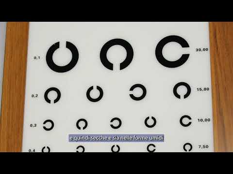 Esame oculistico OCT - Intervista all'oculista di Polimedalab Paolo Annunziata