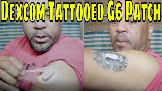 Make Your Dexcom G6 Last 20 Day + With Adhesive Adhesive Tattooed Patches