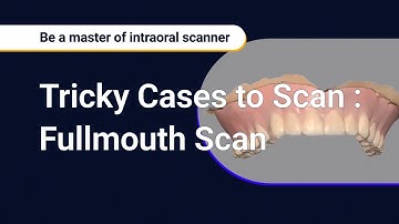 Tricky Cases to Scan : Fullmouth scan
