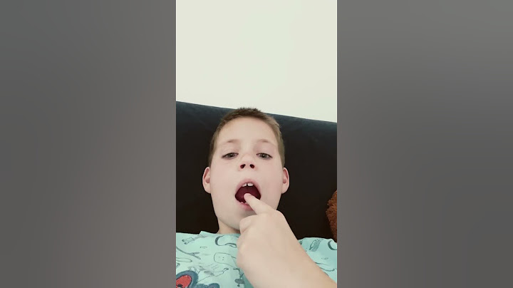 Ááu a kezem