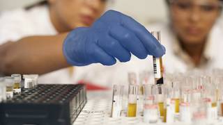 Pathology  Medical Essay Assignment Help Online Australia   UK   USA