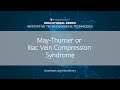 Episode 6 | May-Thurner or Iliac Vein Compression Syndrome