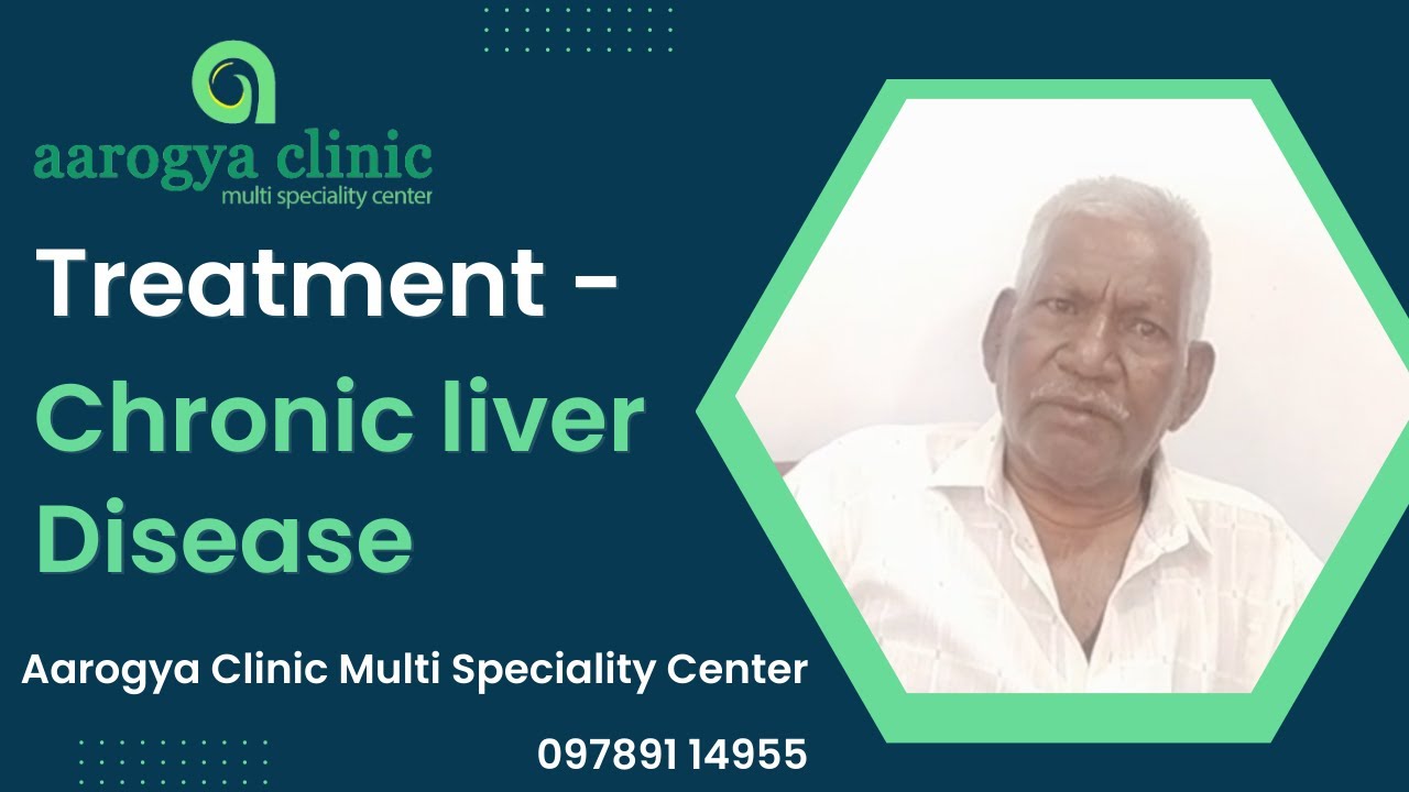 Treatment Chronic Liver Disease Hepatocellular Carcinoma Liver Treatment chronic liver disease hepatocellular carcinoma liver