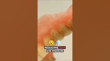 Why Do Some People Prefer Gold Tooth Over Porcelain? 🤔 #short #goldtooth