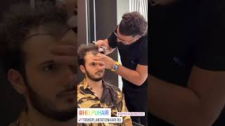 Пересадка Волос В Стамбуле Пересадка Волос Helpu