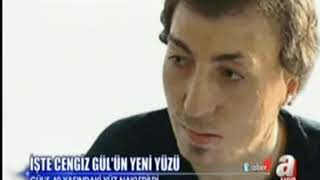 Prof. Dr. Serdar Nasir - Naki̇llerde Bi̇r Üzücü Bi̇r Sevi̇ndi̇ri̇ci̇ Haber - Atv Haber