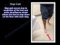 Slap gait , Steppage Gait . Foot Drop - Everything You Need To Know - Dr. Nabil Ebraheim