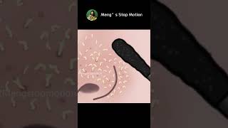 Squeeze & Clean all your blackheads! ASMR animation