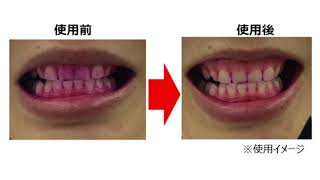 ハビナース 歯みがきティシュ