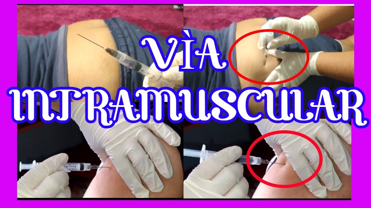 Inyectarse Sitios Para Poner Una Inyección Intramuscular: Método Y Consecuencias ...