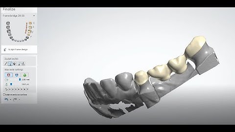 3shape Bridge Framework Design (9 Minutes)