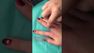 Welche Hand braucht eine Behandlung?!🤔 |Dr. med. Alice Martin #shorts screenshot 4