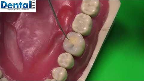 How to approach your caries task