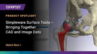 Simpleware Surface Tools – Bringing Together CAD and Image Data
