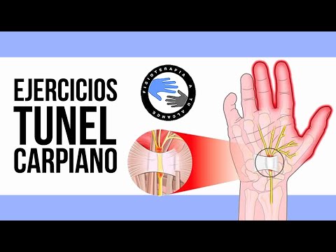 Video: 3 formas de estirar las manos para el síndrome del túnel carpiano