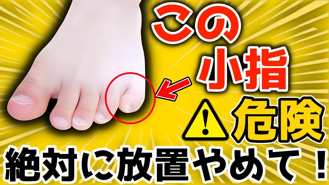 【これ放置してない？ 】 この寝指（内反小趾）3分で解消するだけで！(若返り｜お腹・足痩せ｜内臓脂肪・中性脂肪 減少｜頻尿・外反母趾・腰痛・膝痛・股関節痛 解消)