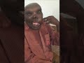Ugliest Man Shocked The World Shorts Ugliest Man Shocked The World Shorts