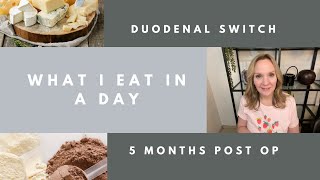 What I Eat In A Day 5 months after Duodenal Switch Surgery! ~ Tina Lee DS