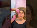 PRF filler: the celebrity secret for natural, collagen-boosted skin