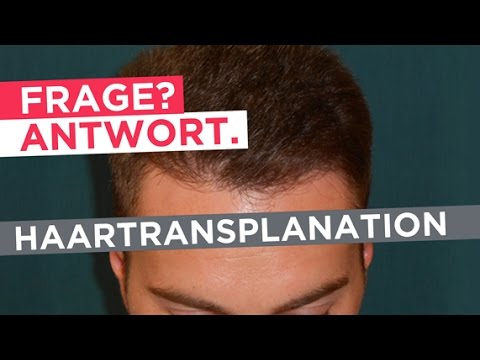 Haartransplantation: Experteninterview - Die wichtigsten Fragen und Antworten zur Haarverpflanzung