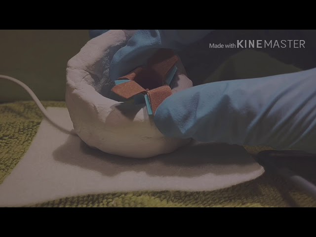 【ASMR】突発性耳垢症候群の対応マニュアル