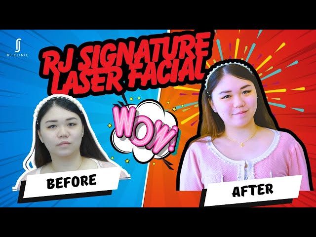 RJ Clinic's Signature Laser Facial Treatment class=