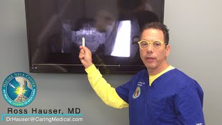 Migraine headaches from unstable c-spine: DMX review with Ross Hauser, MD