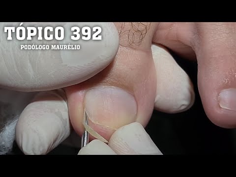 Vídeo: Você sabe cortar as unhas?