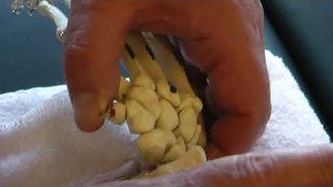 Page 74 Radiocarpal and Ulnocarpal Jts Dorsal Glide of the Proximal Row of Carpals