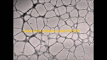 HUVEC cells forming network