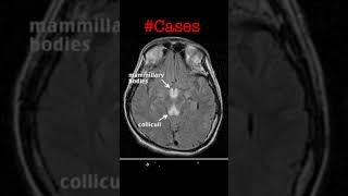 usmle cases