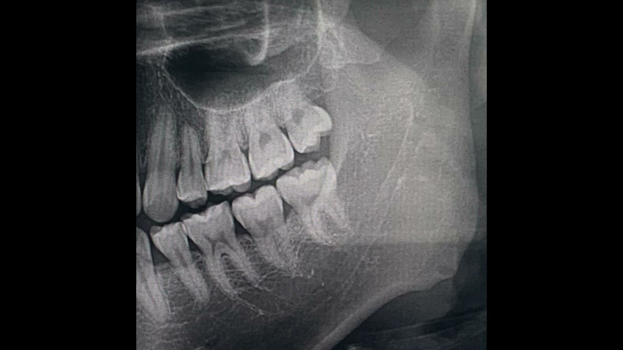 [John Burr (prod. Weirdove)]