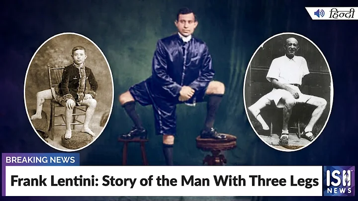 Frank Lentini: Story of the Man With Three Legs  | ISH News