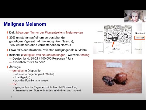 Video: Kann man mehrere Melanome gleichzeitig haben?