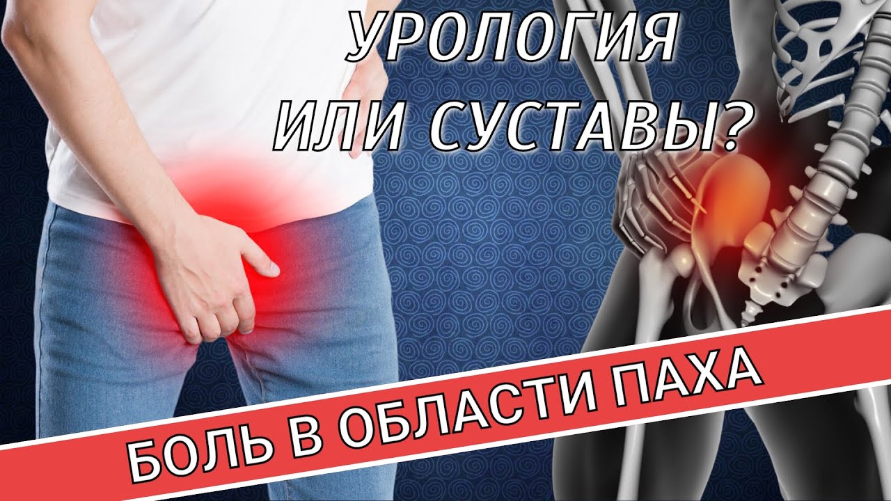 БОЛЬ В ОБЛАСТИ ПАХА: УРОЛОГИЯ ИЛИ СУСТАВЫ?