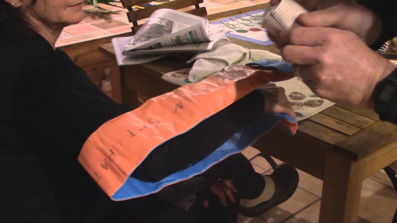 sugar tong splint YouTube