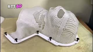 CT-Simulation in Radiotherapy || Thermoplastic mask || @RTT Bd #RTTBd
