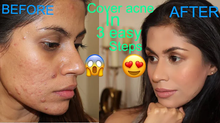 Can BB cream cover acne scars? (2023)