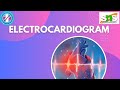 Lead system and Normal ECG /KAVIPRIYA S #snsinstitutions #snsdesignthinkers #designthinking
