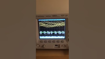 Multistage Audio Amplifier