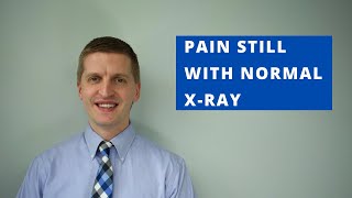 Knee Replacement Xray Normal But Still Have Pain