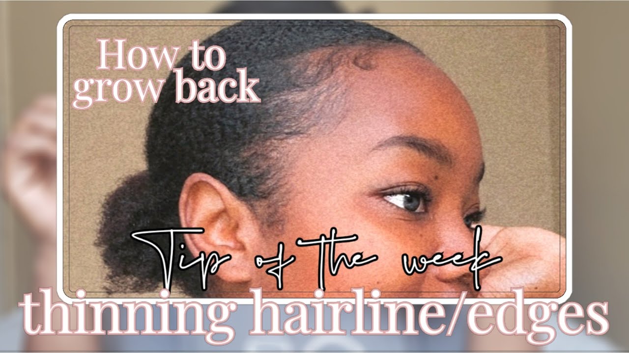 Hair Growth Tip#7 Grow back your edges or hairline |[My journey to waist  length hair] - YouTube