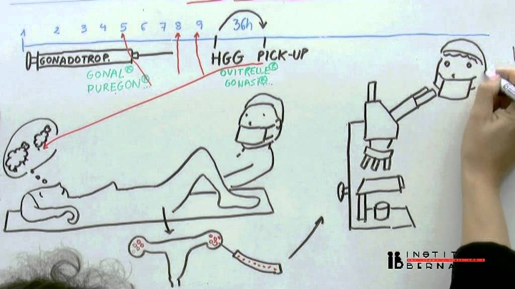 in vitro fertilisation ivf explained simply youtube how ivf works step by step