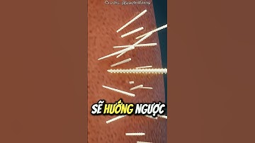 Nếu Bạn Bị Dính Gai Xương Rồng Cholla 😨 (Cực Kỳ Nguy Hiểm)