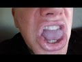 If Tongue Controlled Embouchure TCE is the Holy Grail, Why aren't WE all doing it?