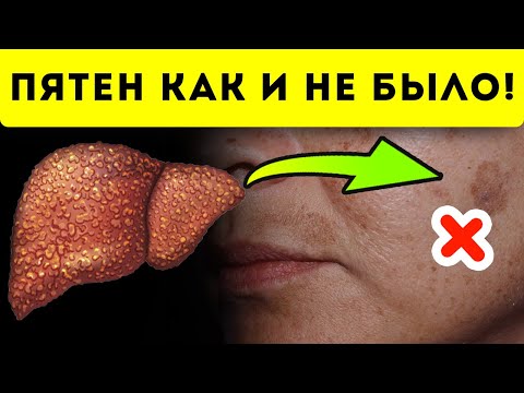 100 эффект! Быстро и дешево выведи пигментные пятна с кожи!