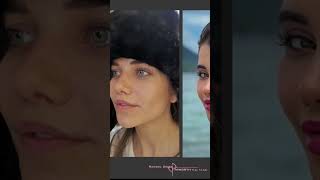 FANTASTIC FACIAL TRANSFORMATION AFTER PLASTIC SURGERY ! PONYTAIL FACELIFT, LIP LIFT &amp; MORE
