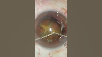 Nuclear 3 = PreSlice 3