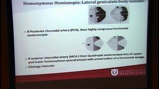 Homonymous Hemianopia [ARCHIVE]