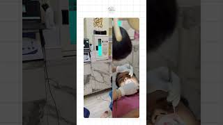 Fix Your Broken Tooth in Just One Session!